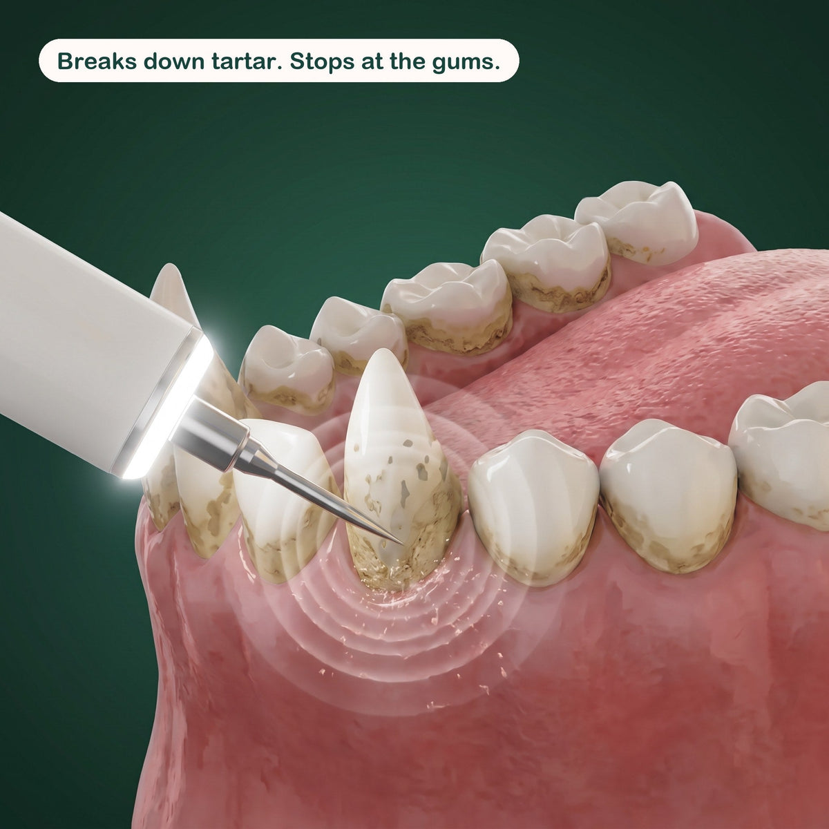 PetRoot™ Silent Ultrasonic Dental Kit